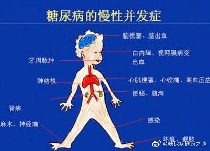 吸烟喝酒对糖尿病人的危害 吸烟喝酒对糖尿病人的危害