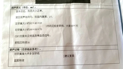 做b超能检查出盆腔炎吗