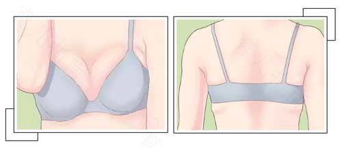 乳腺会引起后背疼 乳腺会引起后背疼