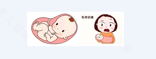 宫内发育迟缓是什么原因导致的 宫内发育迟缓是什么原因导致的
