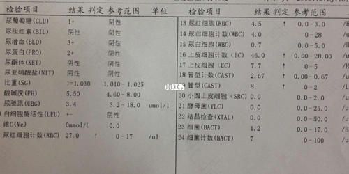 尿常规能检查出肾病吗? 尿常规能检查出肾病吗?