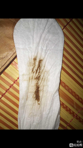 下面有褐色的东西是怎么回事? 下面有褐色的东西是怎么回事?