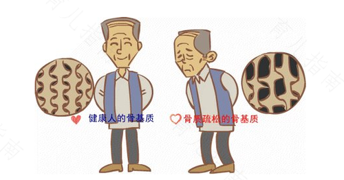 骨头比较软是怎么回事 骨头比较软是怎么回事