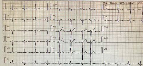 人的心率慢是怎么回事 人的心率慢是怎么回事
