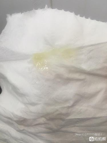 白带黄浓稠浆糊样怎么办