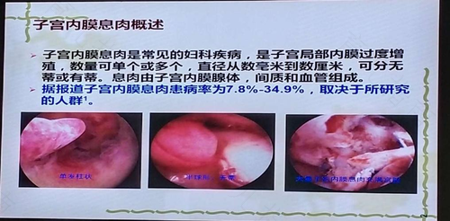 如何避免子宫内膜息肉复发