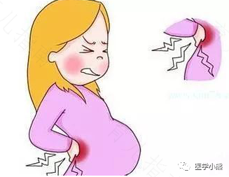 顺产第三天腰疼是怎么回事 顺产第三天腰疼是怎么回事