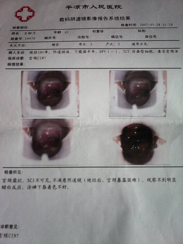 宫颈病变专病门诊看什么病 宫颈病变专病门诊看什么病