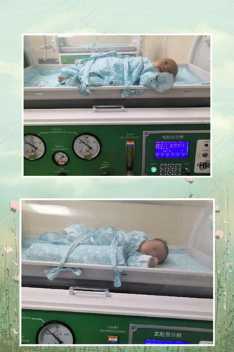 宝宝氧气治疗时的注意事项