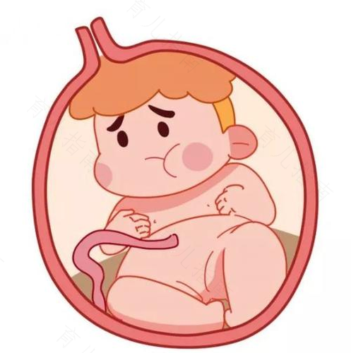 怀有巨大胎儿的准妈妈应该注意什么 怀有巨大胎儿的准妈妈应该注意什么