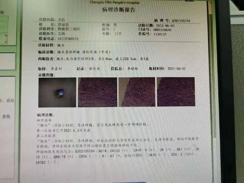 穿刺活检能查出肿瘤是什么性质吗 穿刺活检能查出肿瘤是什么性质吗