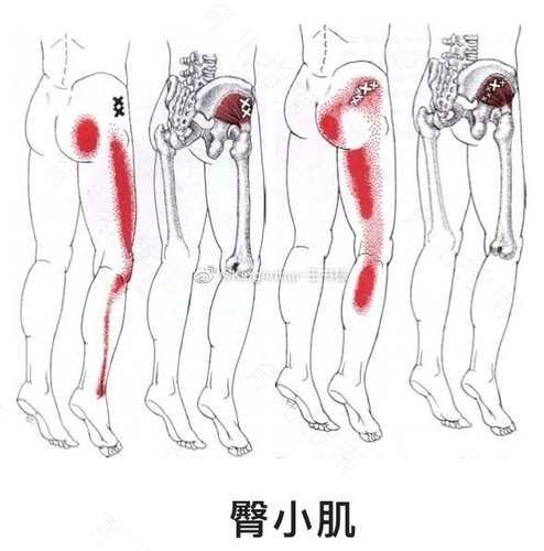 屁股骨头疼怎么回事 屁股骨头疼怎么回事