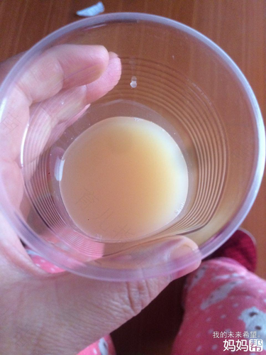 尿有点像米汤怎么回事 尿有点像米汤怎么回事