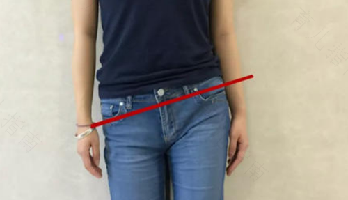 骨盆右边高左边低怎么办 骨盆右边高左边低怎么办
