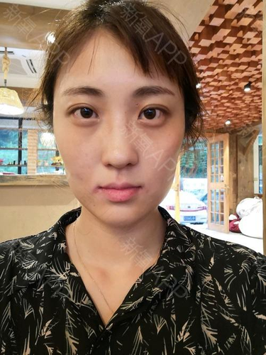 腮帮子肿胀是什么原因 腮帮子肿胀是什么原因