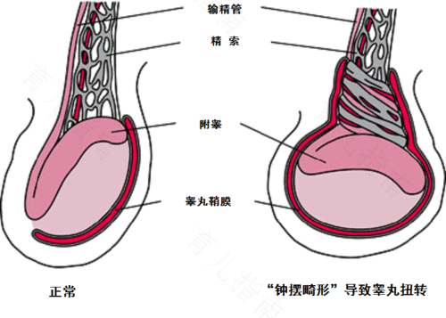 左侧睾丸疼痛是怎么回事儿?