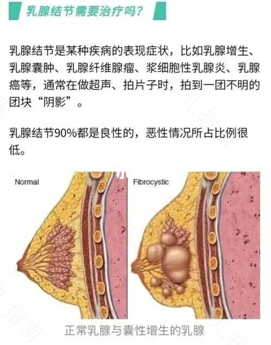 乳腺增生什么引起的?