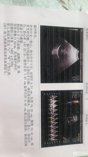 宫颈口硬怎么才能软化生 宫颈口硬怎么才能软化生