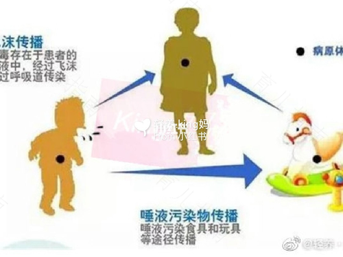 腮腺炎能不能吃鱼肉 腮腺炎能不能吃鱼肉