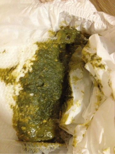 拉黑色疙瘩屎是怎么回事 拉黑色疙瘩屎是怎么回事