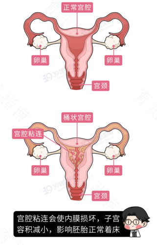 普通人流会痛晕过去吗 普通人流会痛晕过去吗