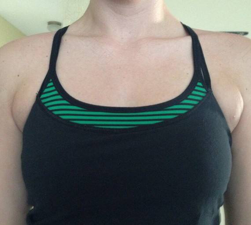 副乳会长乳头出来吗 副乳会长乳头出来吗