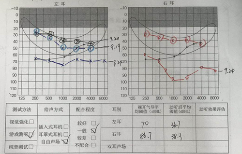 新生儿听力的阶段变化