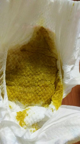 婴儿不正常的大便颜色参照表 婴儿不正常的大便颜色参照表