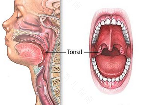 扁桃体炎用什么漱口水 扁桃体炎用什么漱口水