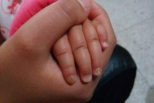 啃手指头怎么办 啃手指头怎么办