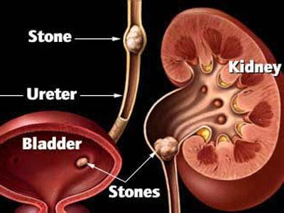 尿道突然疼痛怎么回事