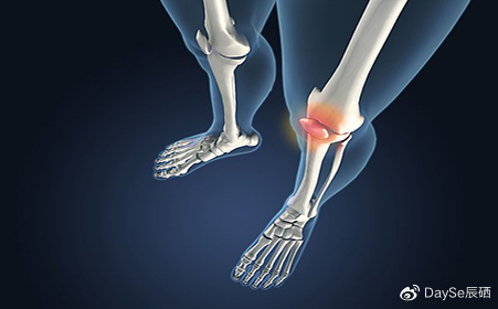 全身关节老是响是因为缺钙吗 全身关节老是响是因为缺钙吗