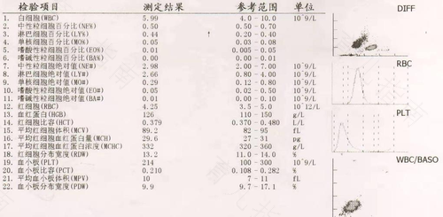 艾滋抗体三周可以排除多少