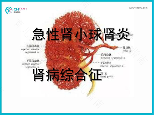 肾炎是什么情况引起的 肾炎是什么情况引起的