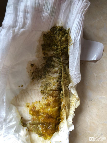 连续拉了好几天肚子怎么回事 连续拉了好几天肚子怎么回事