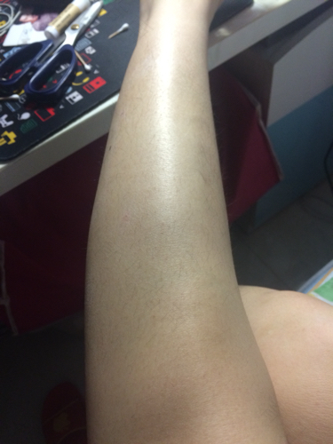 白血病的腿疼是怎么疼 白血病的腿疼是怎么疼