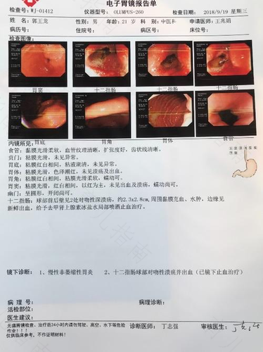 胃溃疡出血能吃什么东西 胃溃疡出血能吃什么东西