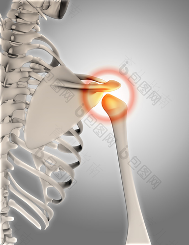 肩膀筋骨拉伤了怎么办 肩膀筋骨拉伤了怎么办