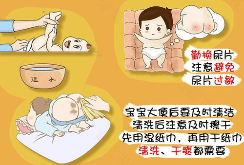 家长该怎样预防宝宝的红屁屁呢