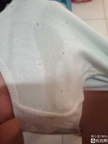 肚脐眼流水臭是怎么回事