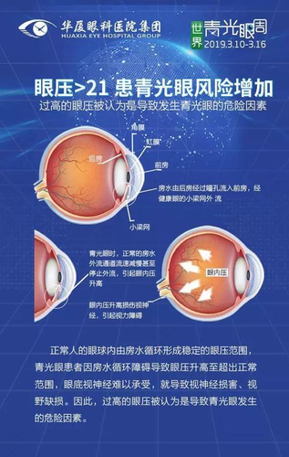 眼压高的症状如何缓解 眼压高的症状如何缓解