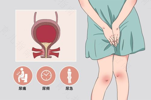 女性性功能障碍的症状及种类