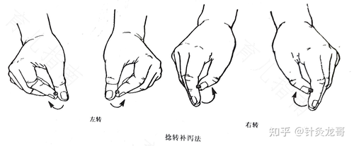 儿童疾病的针刺调理法