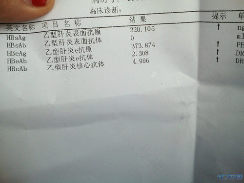 乙肝大三阳腹胀怎么办 乙肝大三阳腹胀怎么办