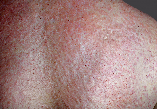 得了恐惧症怎么办? 得了恐惧症怎么办?