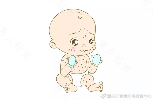 儿童过敏需注意事项 儿童过敏需注意事项