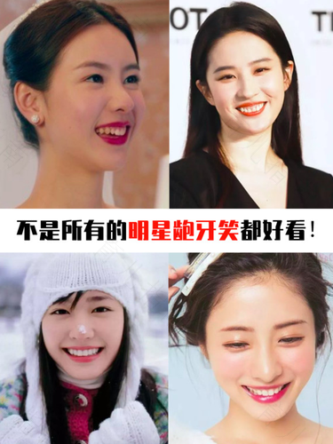 龅牙是怎么形成的原因 龅牙是怎么形成的原因