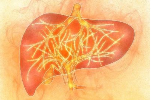 肝火旺会导致便秘吗? 肝火旺会导致便秘吗?