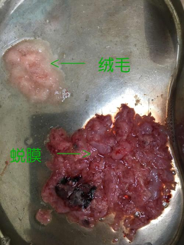 一般人流痛吗需要多长时间 一般人流痛吗需要多长时间