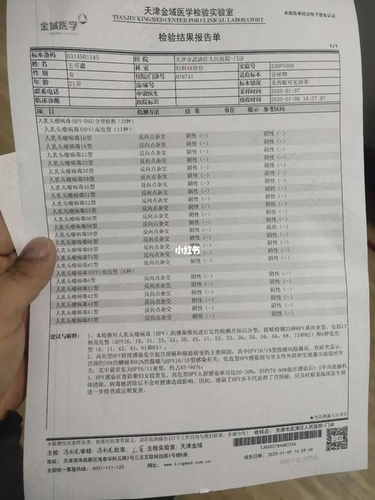 线索细胞阴性(一)什么意思 线索细胞阴性(一)什么意思